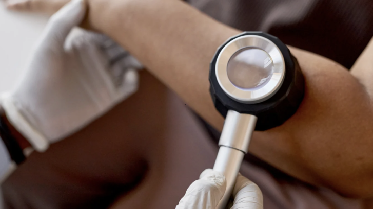 Psoriasis Specialist Appointments in California Maryland